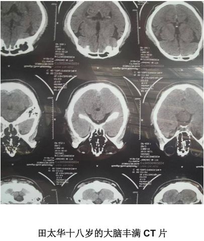 全球顶级健康养生大师—健康生活方式推广大使田太华(图7)