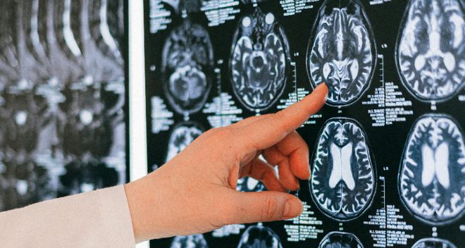 Pg电子平台：卒中康复期：出院后的生活指南(图2)